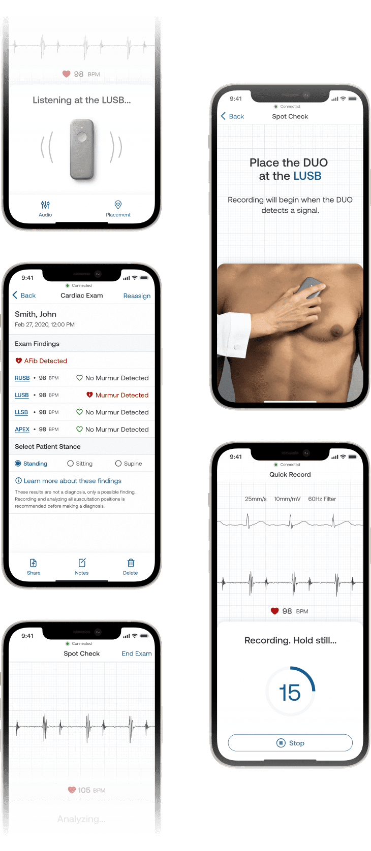 Digital Stethoscopes for Advanced Exams & Virtual Care Eko